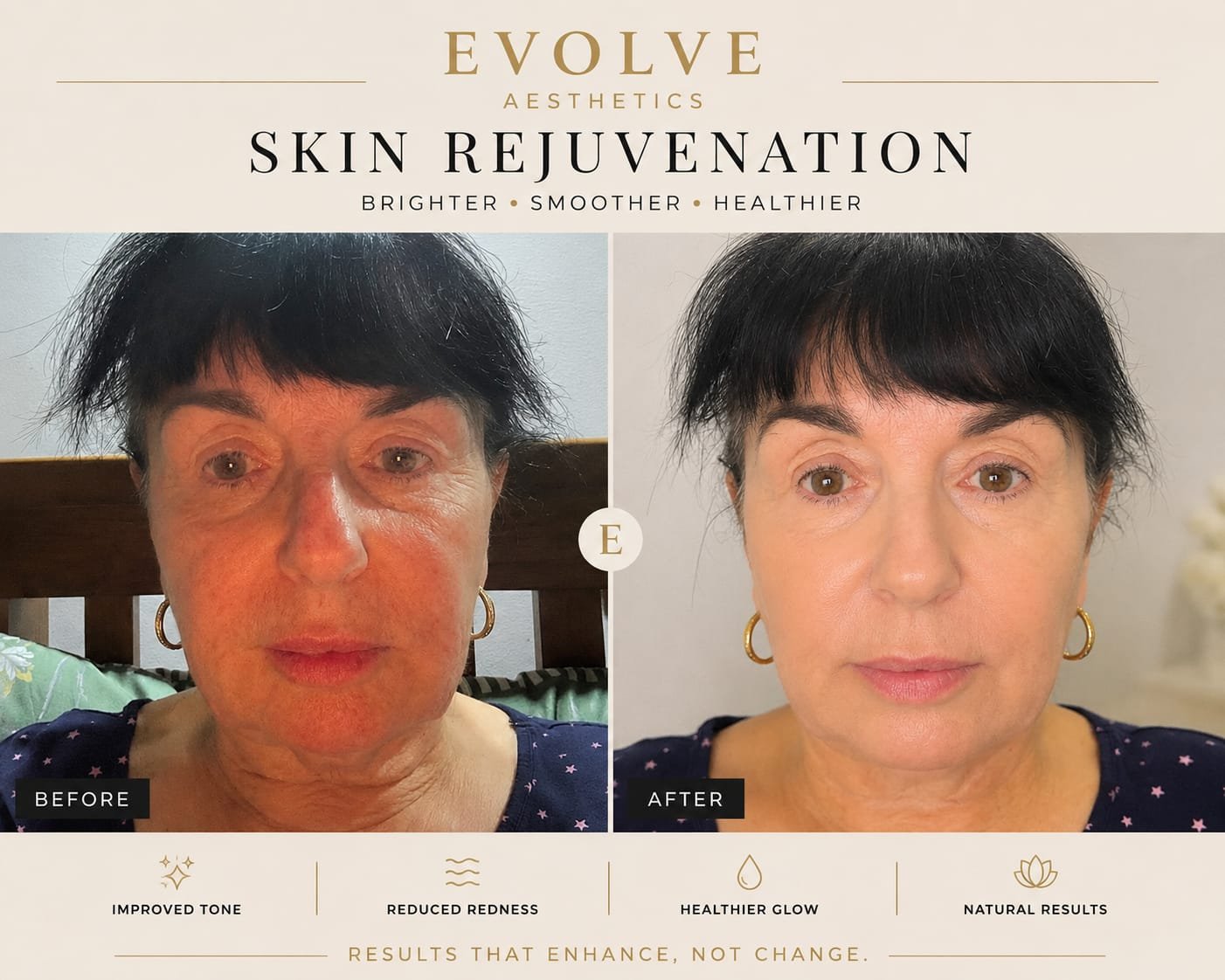 Before and after treatment result