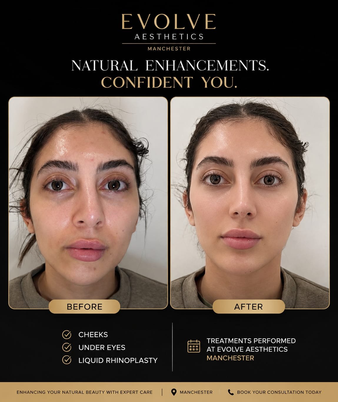Before and after patient result