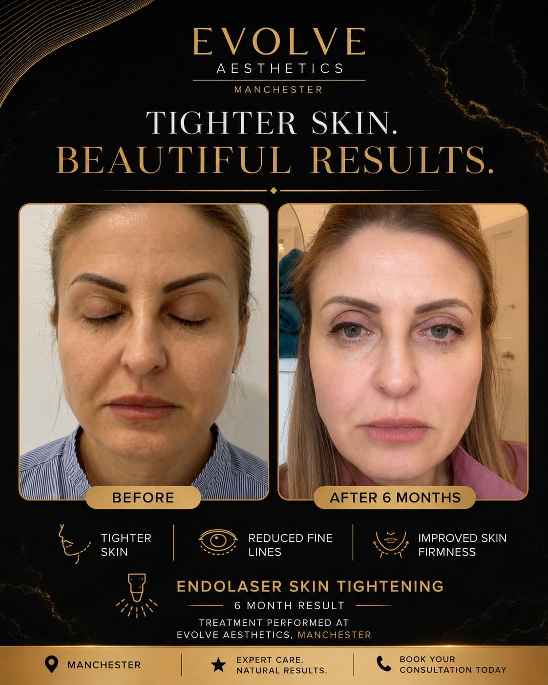 Before and after patient result