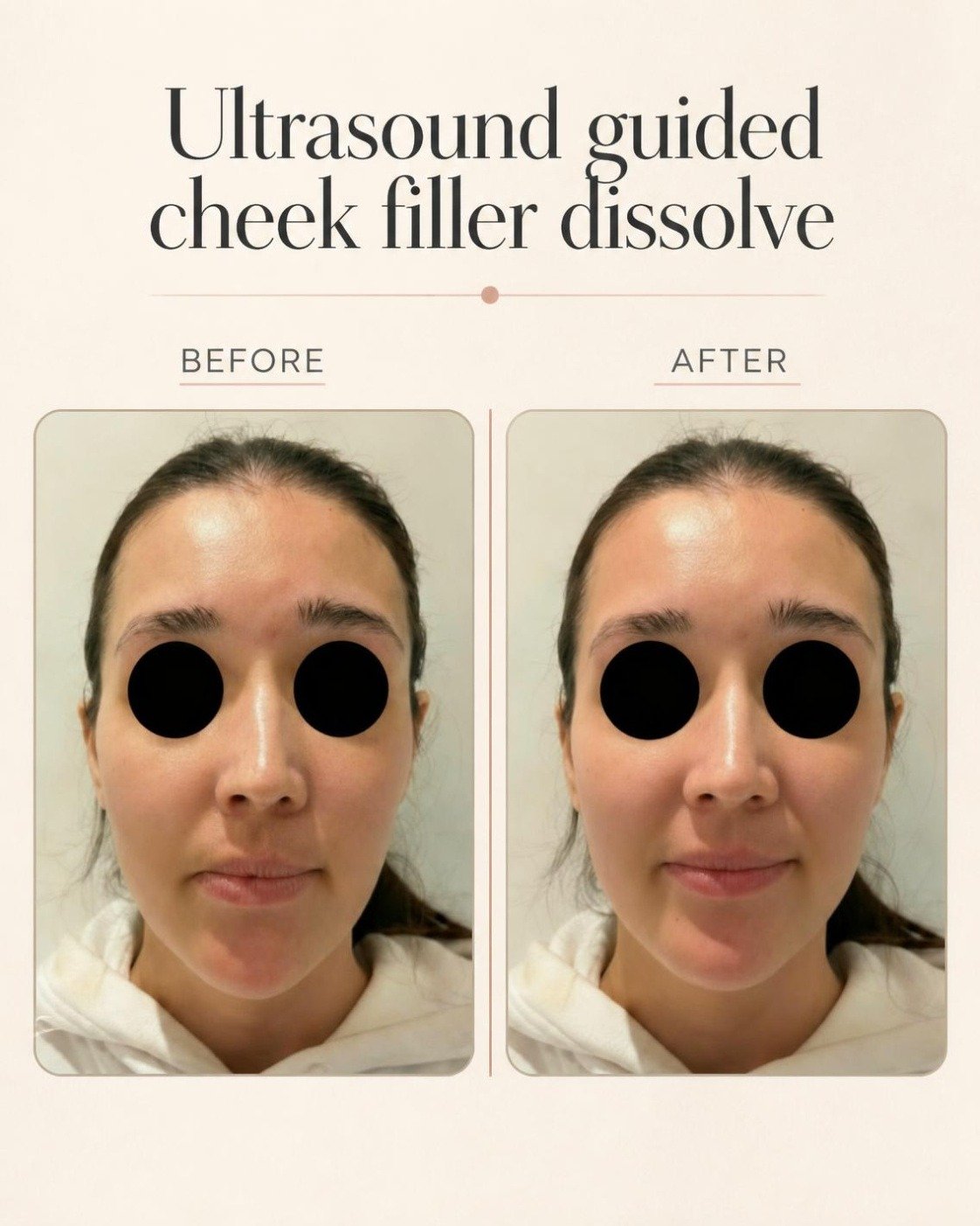 Before and after patient result