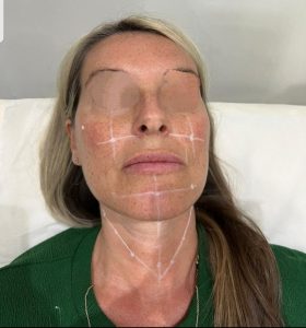 IMG-20240313-WA0009-280x300